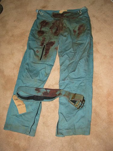 Capa's bloody pants